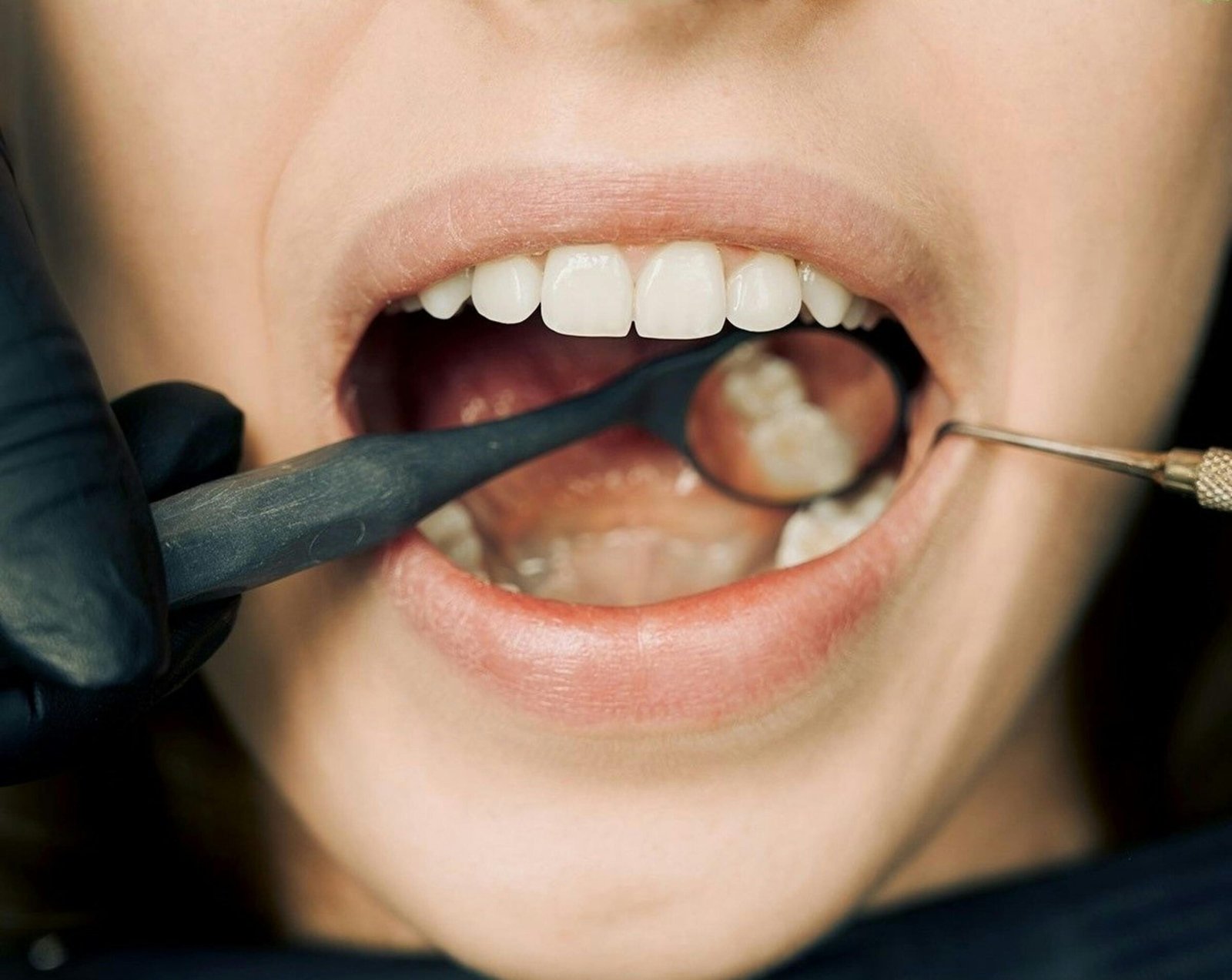 What to Expect During Laser Gum Surgery Recovery: A Day-by-Day Guide