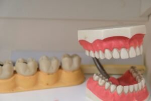 Dental Bridge vs. Implant: Comparing Longevity, Cost, and Comfort