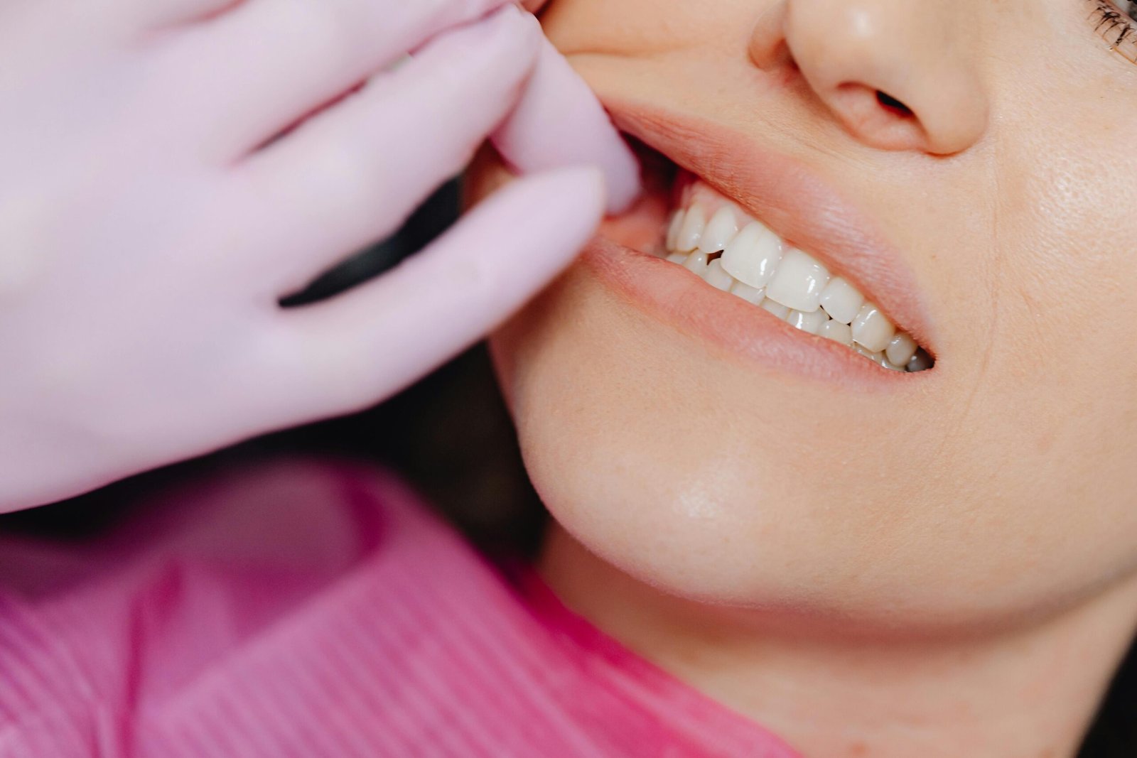 Impacted Wisdom Teeth Removal: Procedure, Risks, and Aftercare